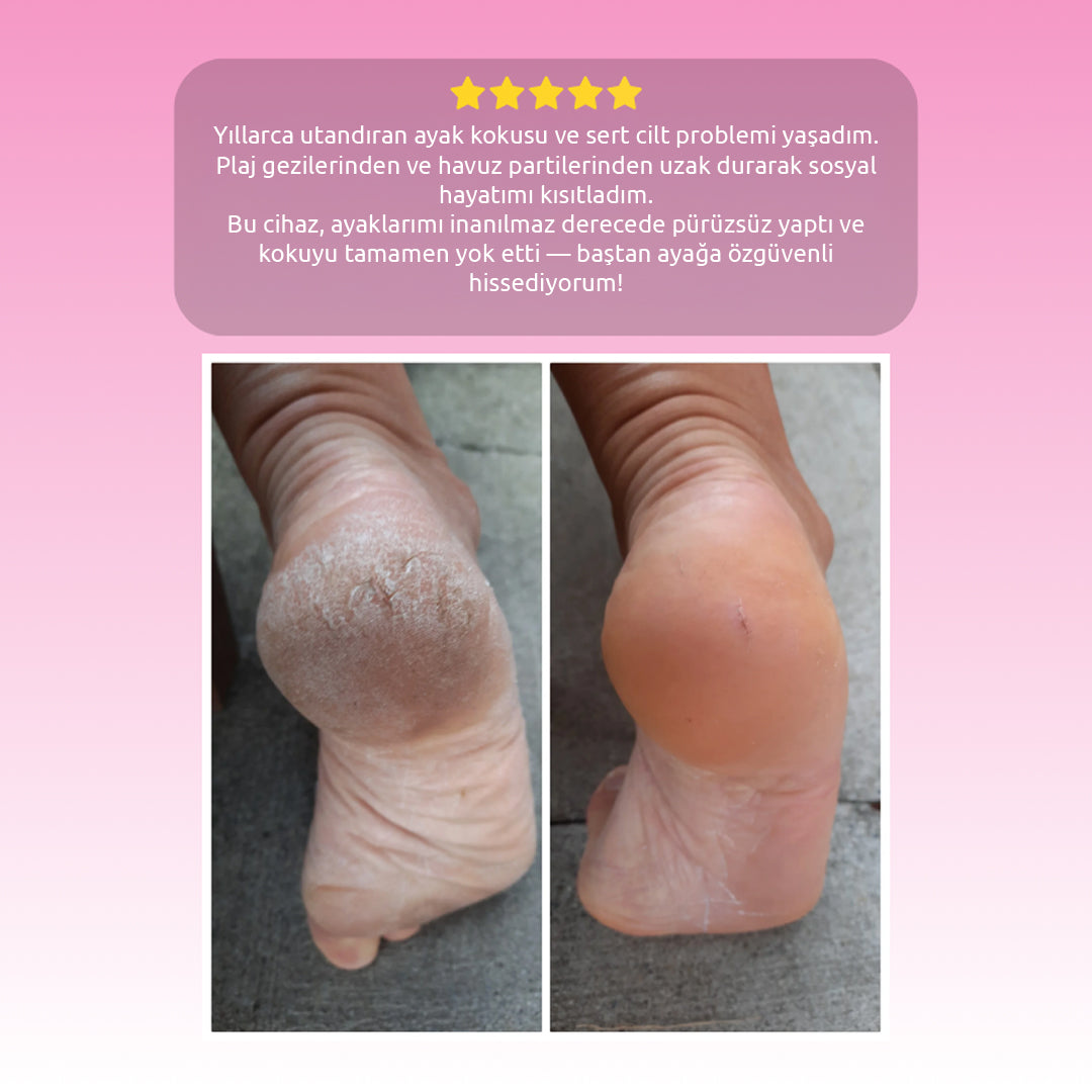 Pluxy PEDIX PRO 3.0