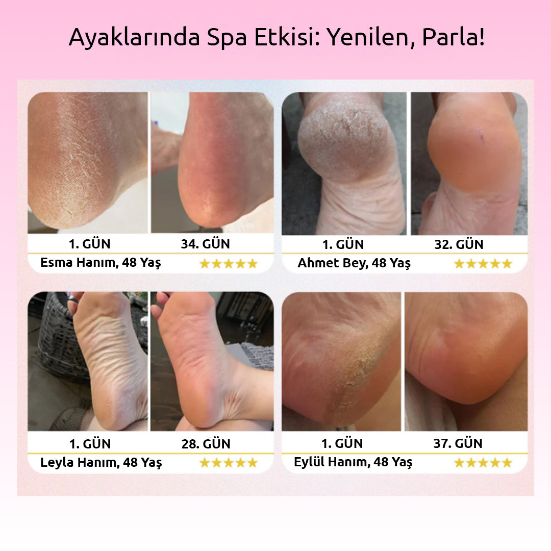 Pluxy PEDIX PRO 3.0